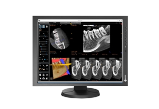 Moniteur-d-examen-clinique-Eizo-RadiForce-MX215-position-couchee