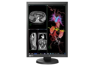 Moniteur-d-examen-clinique-Eizo-RadiForce-MX215-position-debout