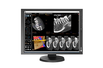 Moniteur d-examen clinique Eizo RadiForce MX215-4-3