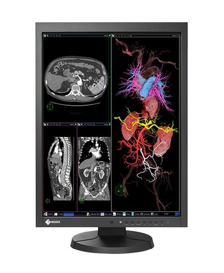 Moniteur d-examen clinique Eizo RadiForce MX215-St